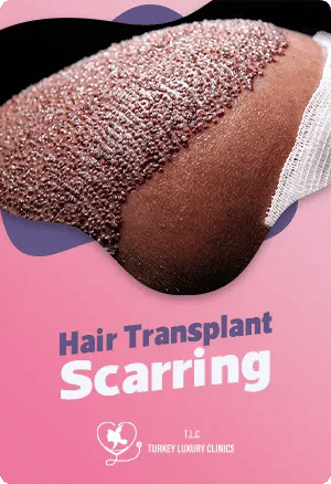 Hair Transplant Scarring