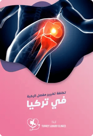 تكلفة عملية تغيير مفصل الركبة في تركياfeatured image