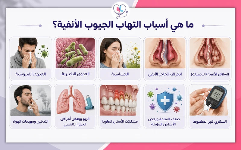 ما هي أسباب التهاب الجيوب الأنفية؟ ما هي أسباب التهاب الجيوب الأنفية؟