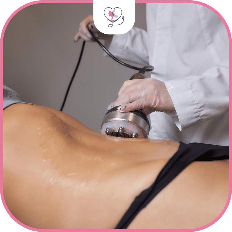 البدائل غير الجراحية لشفط الدهون