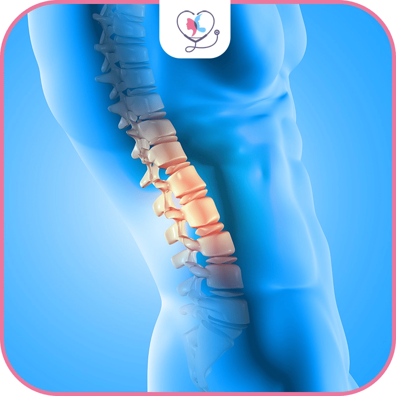 خامساً جراحة الانصهار الفقرية