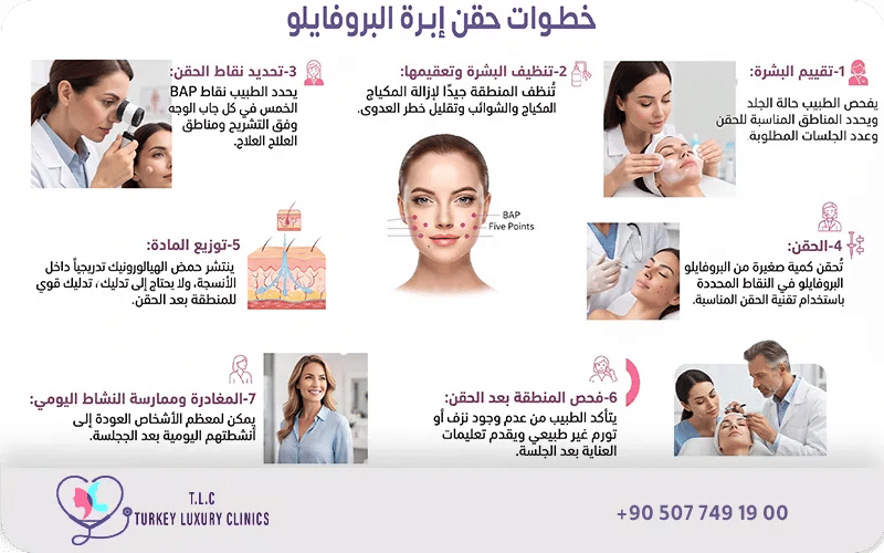 خطوات حقن ابرة البروفايلو