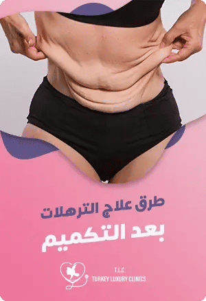 طرق علاج الترهلات بعد التكميمfeatured image