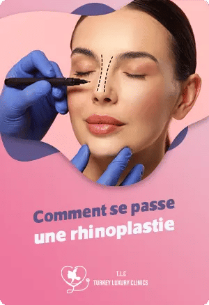 Comment se passe une rhinoplastie ?
