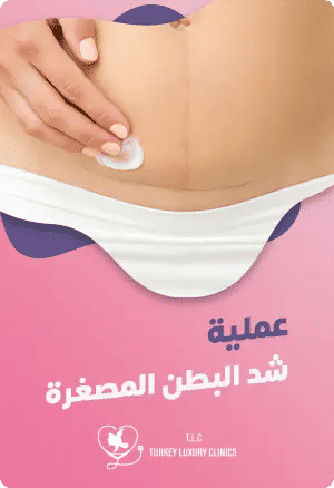 عملية شد البطن المصغرةfeatured image