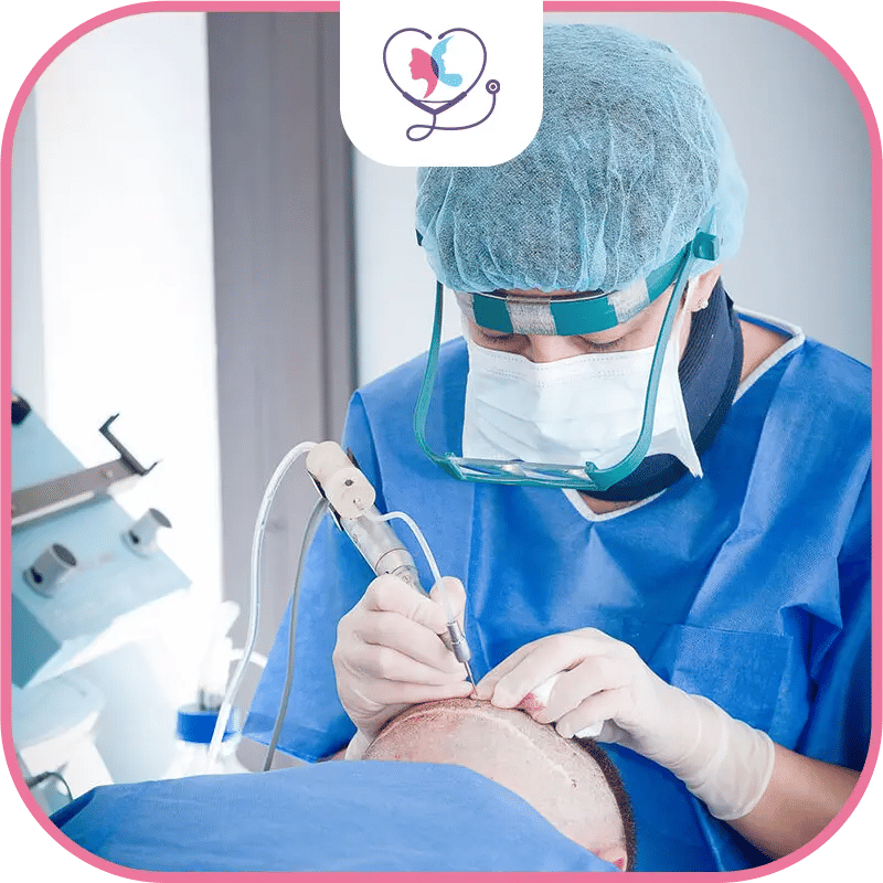 What is the FUE Hair Transplant Procedure