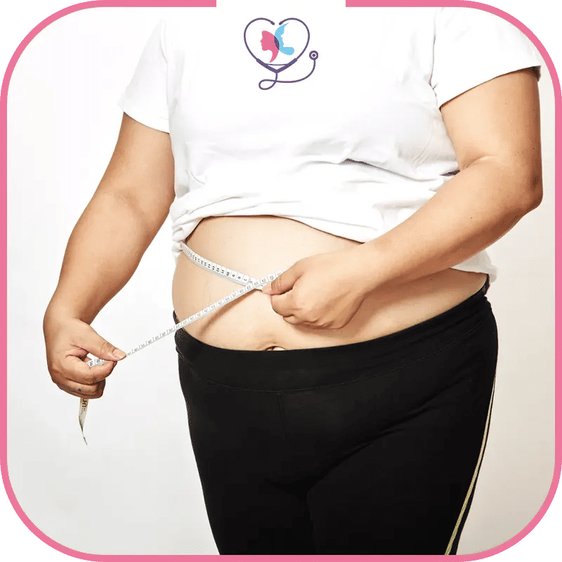 تصنيفات السمنة المفرطة