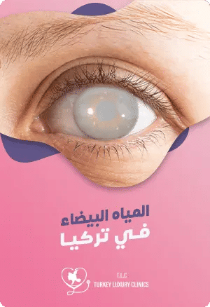 عملية المياه البيضاء في تركيا featured image
