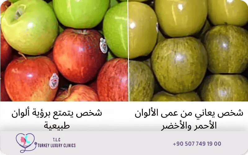 عمى الأحمر والأخضر