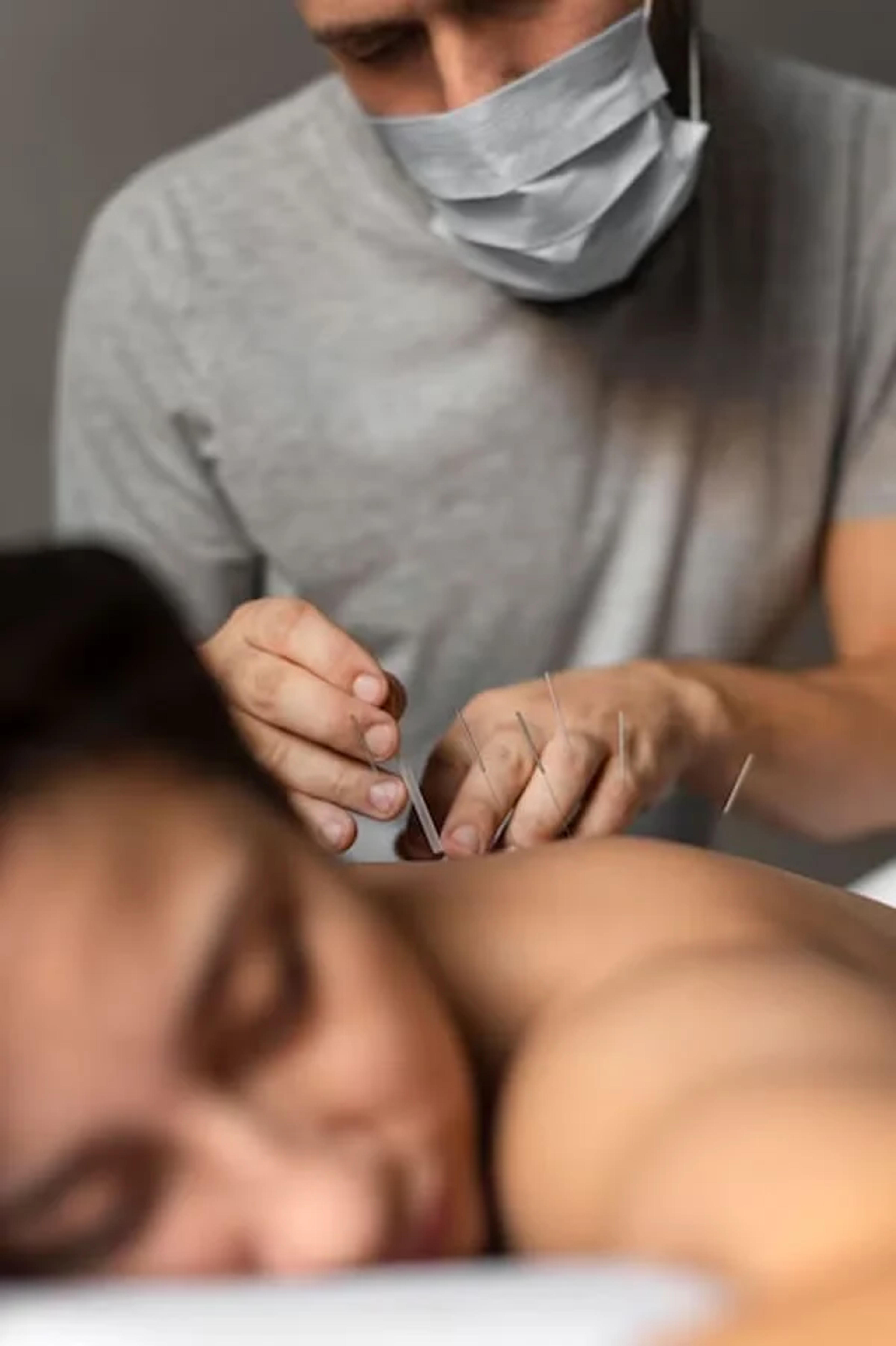 Dr Yang Acupuncture