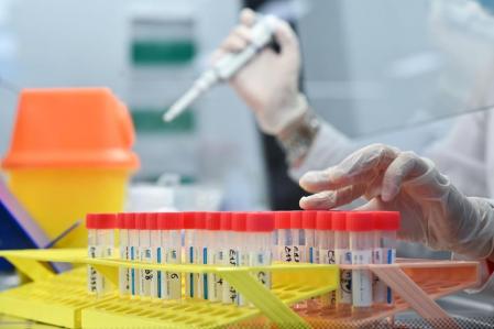 Un técnico de laboratorio utiliza un dispositivo de pipeta para procesar muestras para analizar el nuevo coronavirus Covid-19, en el laboratorio de Biogroup Laboratory en el oeste de Londres el 21 de enero de 2021