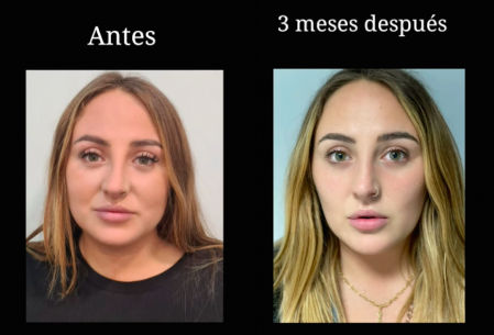 Antes y después de Rocío Flores.
