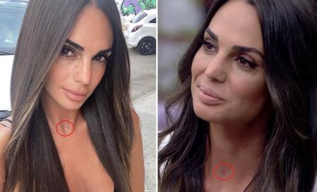 Hasta hace unos días, la modelo lucía un piercing intradermal en su cuello.