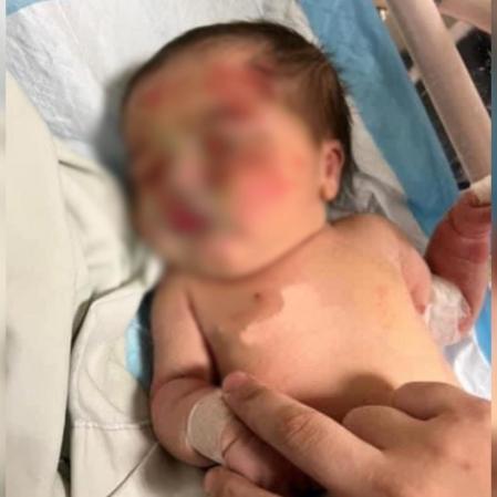 La bebé, con muestras de violencia en su cara