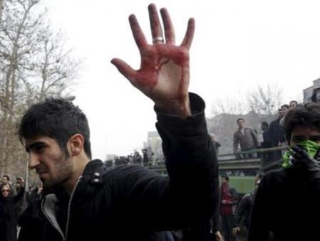 Un Iraní muestra las manos ensangrentada durante unas protestas contra el presidente iraní Mahmud Ahmadineyad en Teherán, Irán.