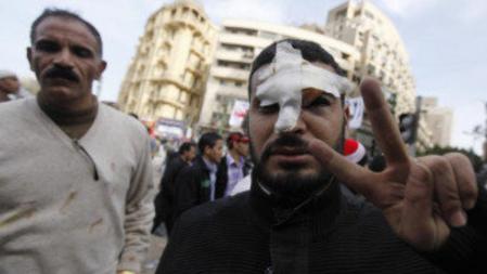 Un hombre con la cara cubierta tras los enfrentamientos en la plaza Tahrir en El Cairo