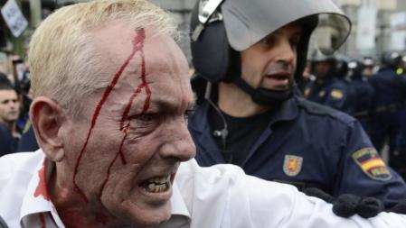 Un hombre herido durante los enfrentamientos entre manifestantes y policías durante las protestas del 25-S