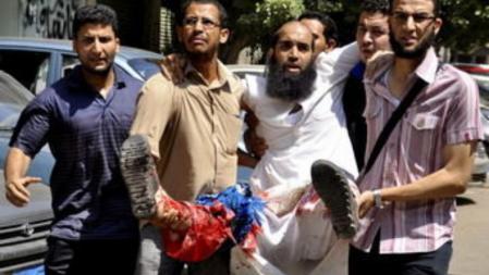 Varios manifestantes trasladan a un hombre herido durante choques entre los Hermanos Musulmanes del depuesto presidente Mohamed Morsi y detractores del mismo, en la calle Mourad de Giza