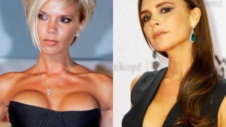 Victoria Beckham con implantes (izquierda) y sin implantes en 2013 (derecha)