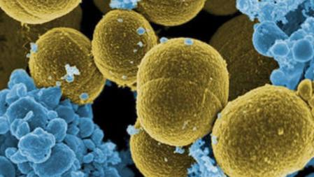 La bacteria 'Staphylococcus aureus' escapando de la destrucción por leucocitos humanos