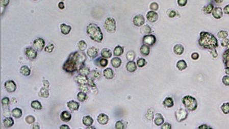 Los investigadores han probado la vacuna en ratones y han concluido que es altamente eficaz