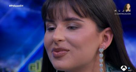 Nathy Peluso presumió en 'El Hormiguero' de tener un ojo de cada color