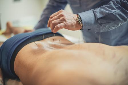 man having acupuncture treatment .
