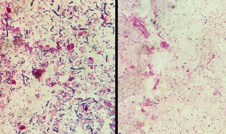 A la izquierda, imagen desde el microscopio de flora intestinal sana; a la derecha, flora intestinal de baja diversidad