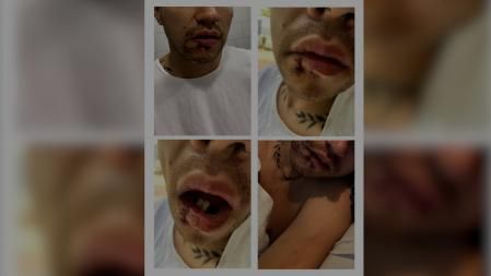 Agresión homófoba barcelona