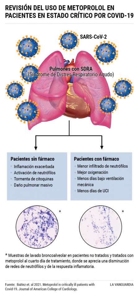 Revisión del uso de Metoprolol para el tratamiento del síndrome de dificultad respiratoria (SDRA) en pacientes en estado crítico por Covid-19