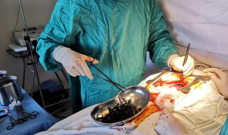 Los cirujanos del Hospital de Klaipeda estuvieron tres horas sacando objetos metálico