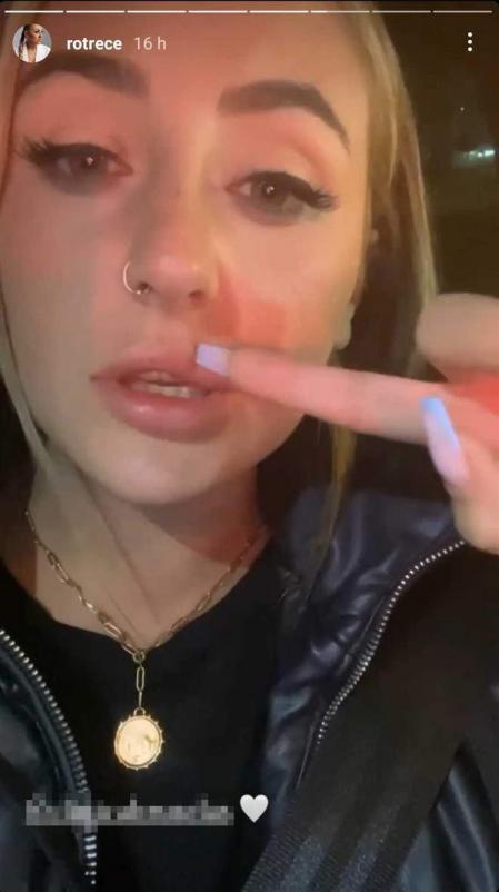 Rocío Flores explica sus retoques