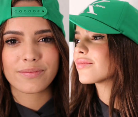 Gloria Camila antes y después de la intervención en los labios