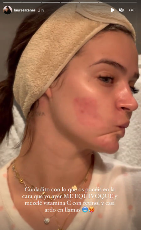 Laura sufría un pequeño accidente doméstico