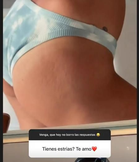 Escanes muestra sus estrías ante sus seguidores