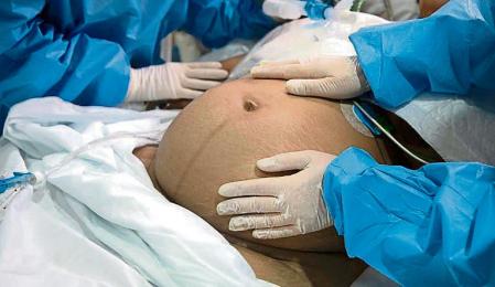 Embarazada con Covid en la UCI de Valle Hebron, el bebé está sano pero la madre permanece intubada e inconsciente, las enfermeras comentan que no estaban vacunadas por consejo médico.