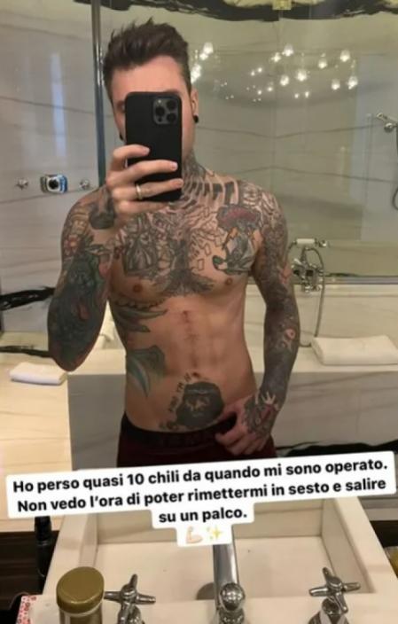 Fedez muestra su cambio físico en redes sociales