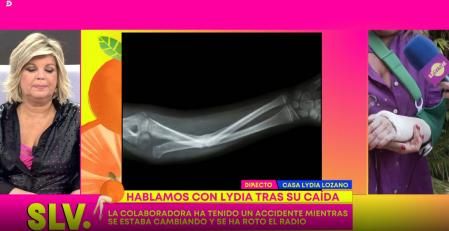 La presentadora se ha roto el radio