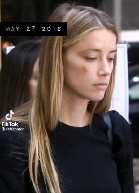 Amber Heard, el 27 de mayo de 2016, con marcas visibles en su rostro.