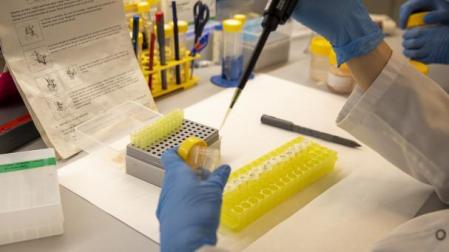 Sanidad alerta de varios casos sospechosos de viruela del mono en Madrid