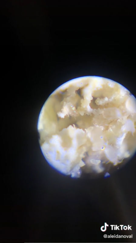 Los ácaros se distinguen perfectamente de las imágenes