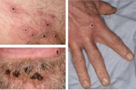 Viruela del mono
AGENCIA DE SEGURIDAD SANITARIA D
  (Foto de ARCHIVO)
01/01/1970