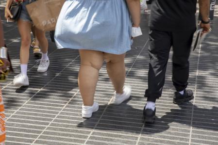 LAS PIERNAS DE UNA MUJER CON PROBLEMAS DE SOBREPESO