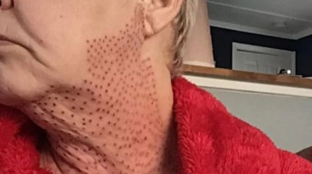 El resultado de la operación fue un desastre