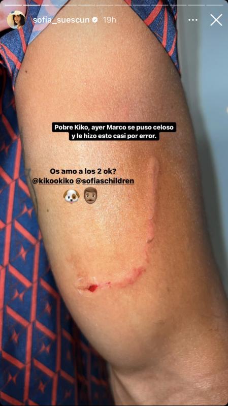 Sofía Suescun muestra el brazo de Kiko Jiménez tras el percance con Marco