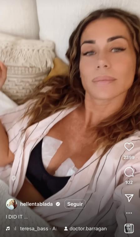 Elena Tablada comparte un Reels con su post operatorio