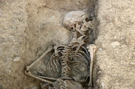 Restos de un soldado republicano hallados en la fosa de Canturri