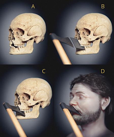 El hacha creó una herida desde la mandíbula hasta la nariz