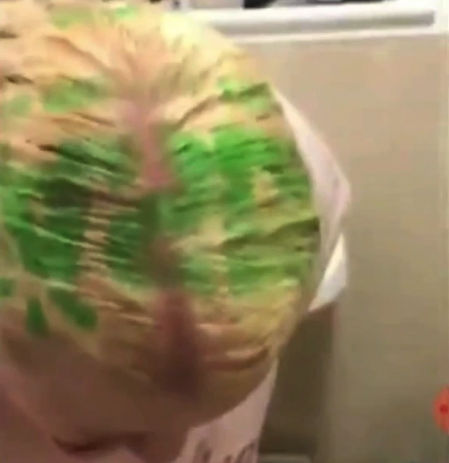 Una reacción química entre el tinte y la bolsa hizo que el logotipo verde brillante se transfiriera a su pelo