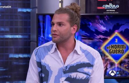 Eduardo Navarrete presumió de cambio físico gracias a sus operaciones estéticas